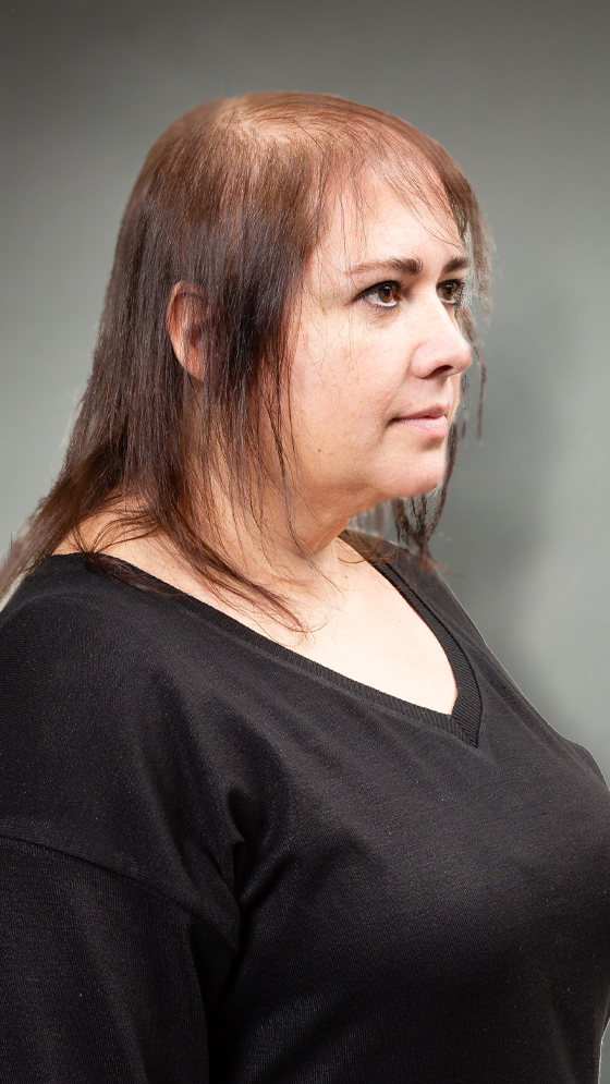 infoltimento donna - nicoletta