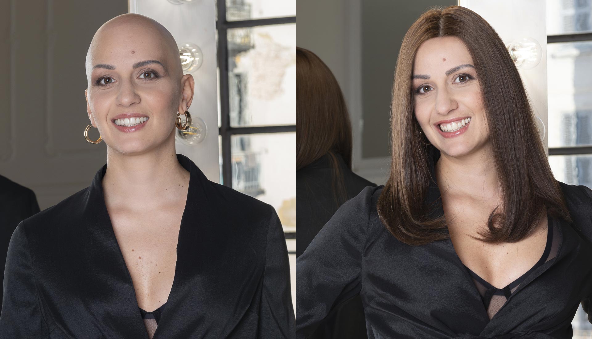 parrucche per alopecia e chemioterapia