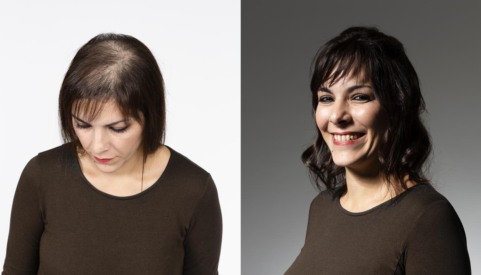 infoltimento capelli