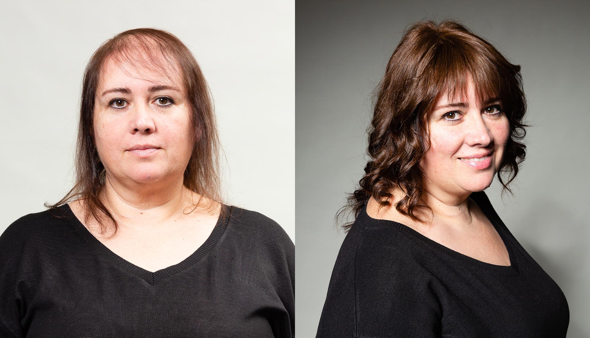 infoltimento capelli donna