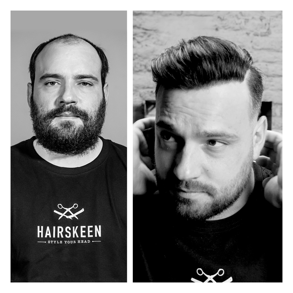 soluzioni per calvizie uomo