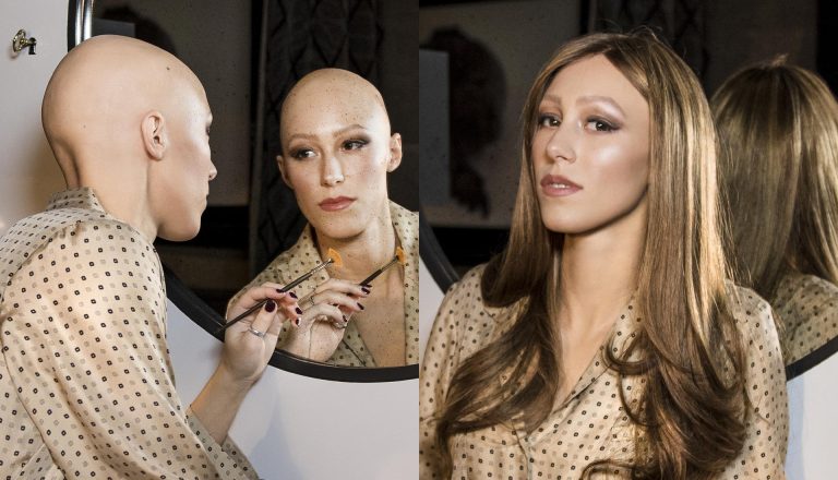 scegliere una parrucca per alopecia