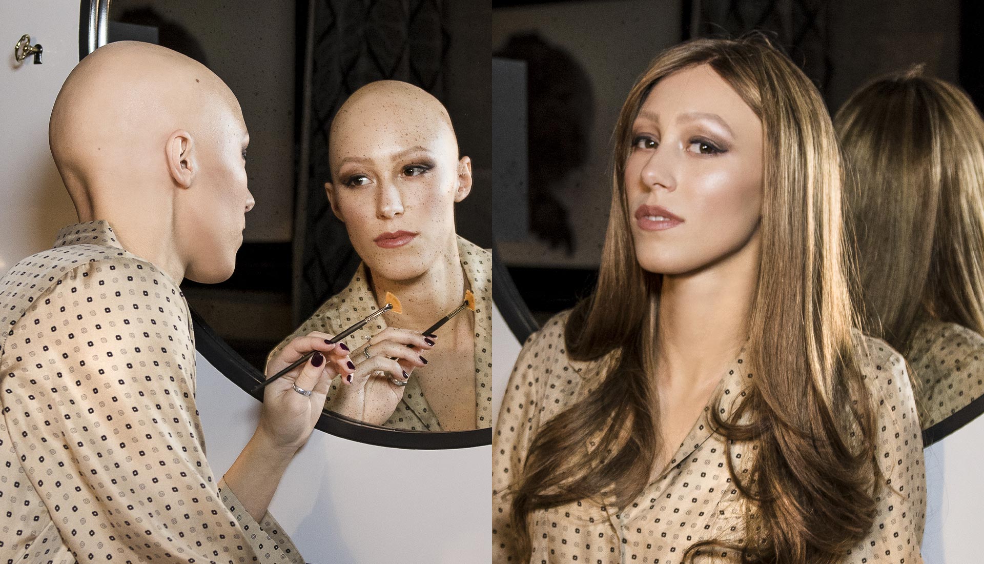 scegliere una parrucca per alopecia