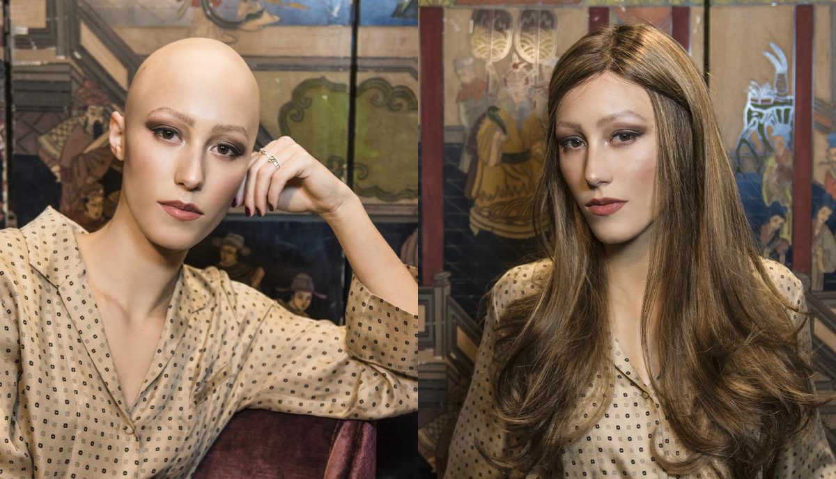 scegliere una parrucca per alopecia